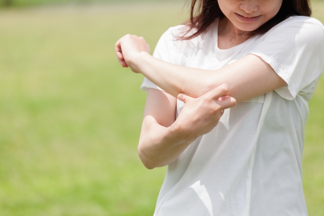 蚊の対策：蚊に刺されて痒がっている女性
